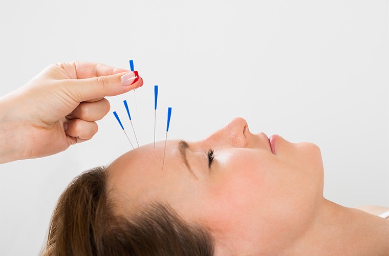 Hot Acupuncture; HSPs and Pain